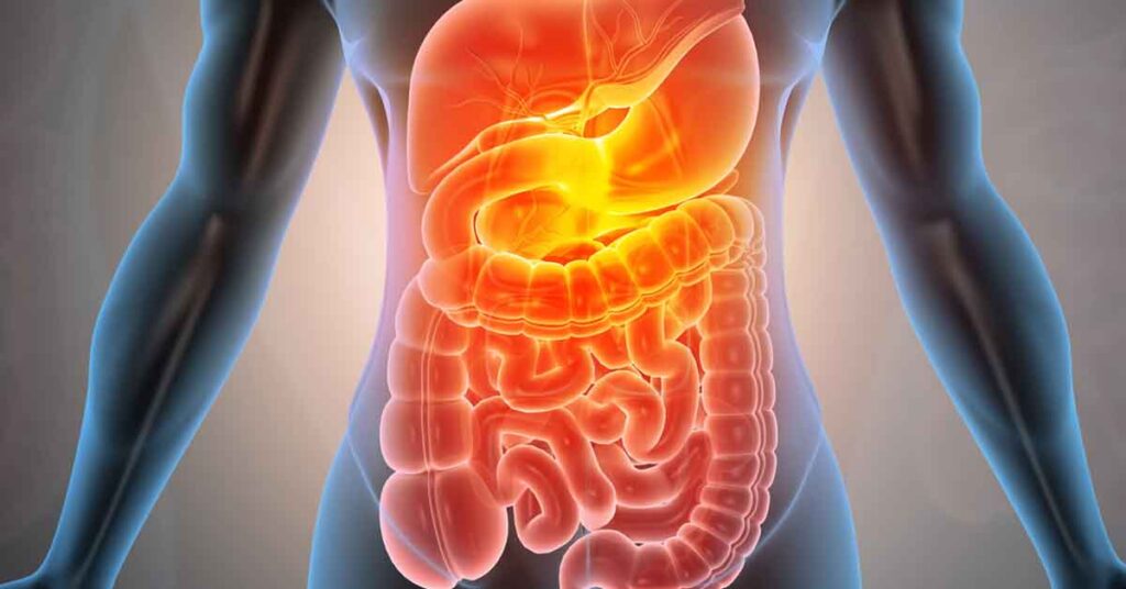 Mitos comuns sobre câncer do aparelho digestivo: Desmistificando informações incorretas