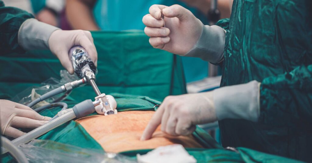 Conheca os principais beneficios da videolaparoscopia (1)